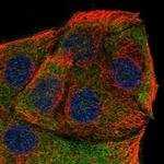 CYB5D2 Polyclonal Antibody