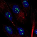 MAGEH1 Polyclonal Antibody