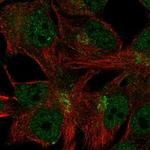 C11orf24 Polyclonal Antibody