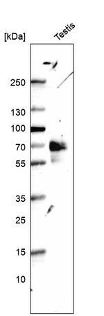 ILDR2 Antibody in Western Blot (WB)