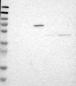 B3GNT7 Antibody in Western Blot (WB)