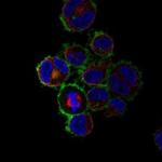 CD30 Antibody in Immunocytochemistry (ICC/IF)