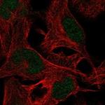 ZNF237 Antibody in Immunocytochemistry (ICC/IF)