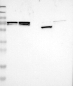 MFAP1 Antibody in Western Blot (WB)