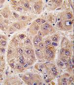 PIM3 Polyclonal Antibody