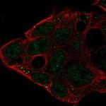 PUNC Polyclonal Antibody