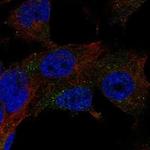 HEXA Polyclonal Antibody