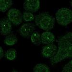 CHN2 Polyclonal Antibody