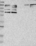 PARP3 Antibody in Western Blot (WB)