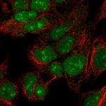 PINX1 Antibody in Immunocytochemistry (ICC/IF)