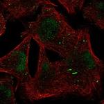 BTBD1 Polyclonal Antibody