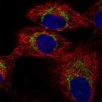 TRMT61A Polyclonal Antibody