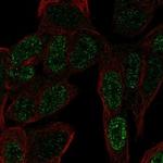 ZNF568 Polyclonal Antibody