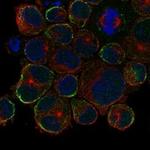 KRT35 Antibody in Immunocytochemistry (ICC/IF)