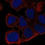 AKAP7 Polyclonal Antibody