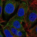 SAPAP3 Antibody in Immunocytochemistry (ICC/IF)