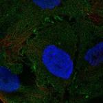 NMUR2 Polyclonal Antibody