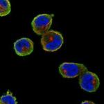 TXNDC3 Polyclonal Antibody