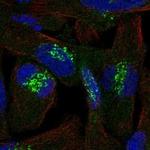 TSPAN31 Polyclonal Antibody