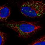 BCKDHB Polyclonal Antibody