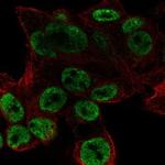 ODAM Polyclonal Antibody