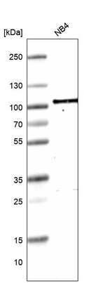 TAGAP Antibody in Western Blot (WB)