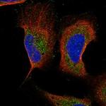 LC3B Polyclonal Antibody