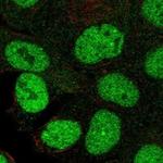 KMT2E Polyclonal Antibody