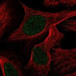 TRAPPC12 Polyclonal Antibody