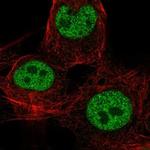 CDX4 Polyclonal Antibody