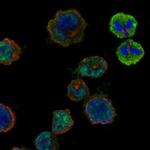 HORMAD2 Polyclonal Antibody