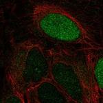 LEKR1 Polyclonal Antibody