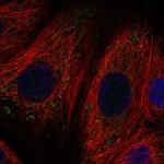 SLC11A1 Polyclonal Antibody