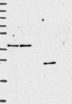 ZFAND6 Antibody in Western Blot (WB)