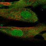 SSC5D Polyclonal Antibody