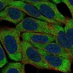 KLRF1 Polyclonal Antibody