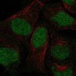 ANKRD20A3P Polyclonal Antibody