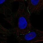 DPPA5 Polyclonal Antibody