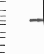 SLC28A1 Antibody in Western Blot (WB)