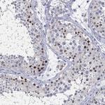 Histone H1.1 Antibody in Immunohistochemistry (Paraffin) (IHC (P))