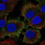 XP32 Polyclonal Antibody