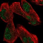 USP12 Polyclonal Antibody
