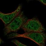 DND1 Polyclonal Antibody