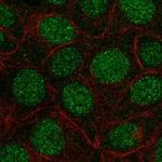 FAM90A1 Polyclonal Antibody