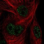 FAM71A Polyclonal Antibody