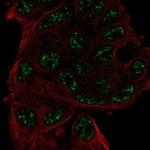 ANKRD55 Polyclonal Antibody