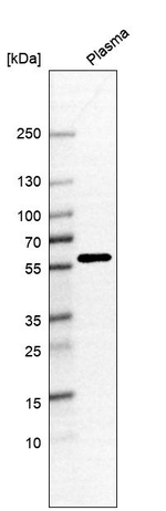 ANKRD55 Antibody in Western Blot (WB)