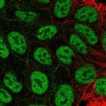 MFAP3L Antibody in Immunocytochemistry (ICC/IF)