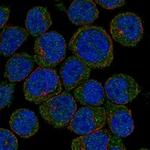 CLECL1 Polyclonal Antibody