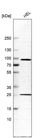 KELL Antibody in Western Blot (WB)